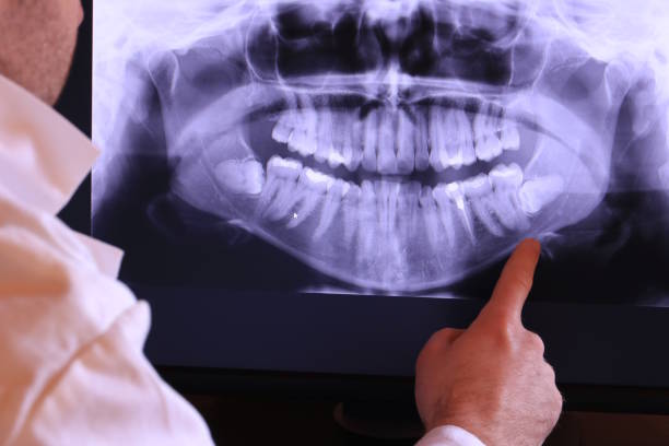 Best Emergency Dental Care for Abscessed Tooth in Romancoke, MD